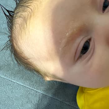 Mustela Şampuan Ve Losyonu Oğlumu Mahvetti