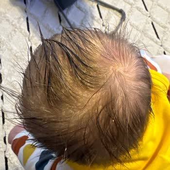 Mustela Şampuan Ve Losyonu Oğlumu Mahvetti