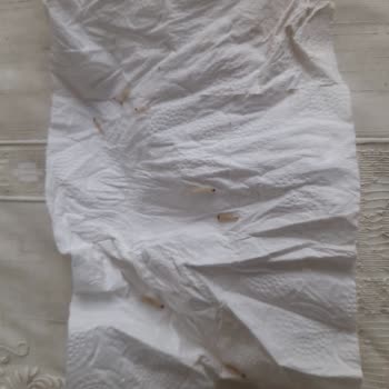 Tat Bakliyat Tat Baldo Pirinç İçin Şikayet