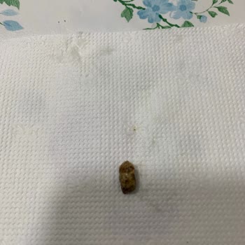 A101 Tahin Helvasından Diş Çıktı