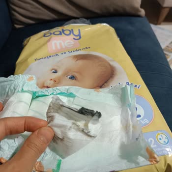 ebebek Bebek Bezinin İçinden Yabancı Cisim Çıktı!