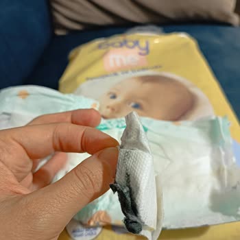 ebebek Bebek Bezinin İçinden Yabancı Cisim Çıktı!
