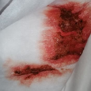 Farmina Bayat Ve Sağlıksız Koşullarda Üretilmiş Bir Mama