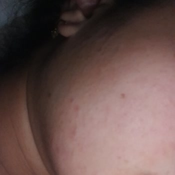 The Purest Solutions Markanın Tüm Ürünleri Yüzümü Mahvetti