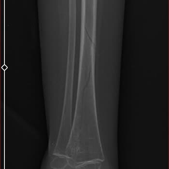 Ankara Cebeci Tıp Fakültesi Çocuk Yoğun Bakım