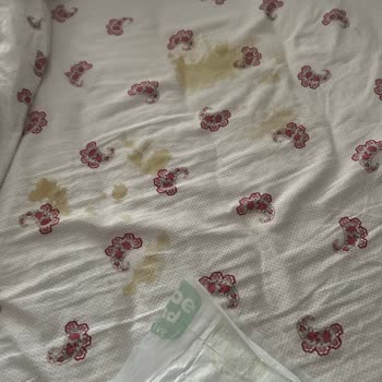 Prima'da Yaşadığımız Yoğun Sızıntı