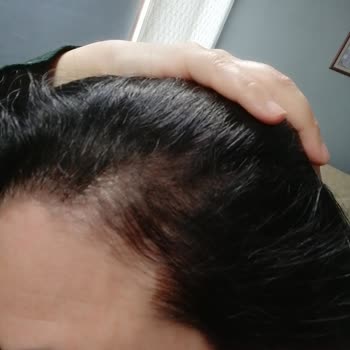 Garnier Hayal Kırıklığına Uğratan Saç Boyası Deneyimi