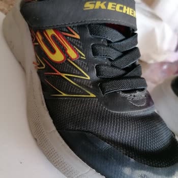 Skechers Kalitesiz Ürünleri İle Tüketicisini Mağdur Ediyor!