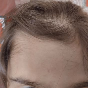 Ziraat Bankası Sonradan Taksitlendirme Yapılamıyor