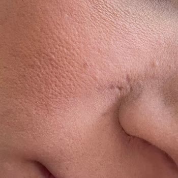Lakiasalon (Instagram) Antalya Mağdur Olmam