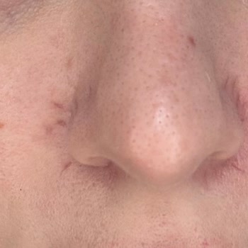 Lakiasalon (Instagram) Antalya Mağdur Olmam