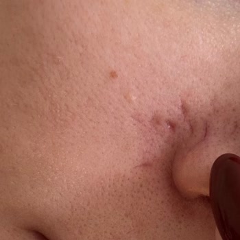 Lakiasalon (Instagram) Antalya Mağdur Olmam