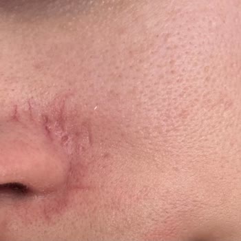 Lakiasalon (Instagram) Antalya Mağdur Olmam