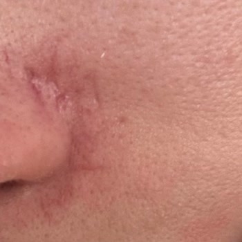 Lakiasalon (Instagram) Antalya Mağdur Olmam