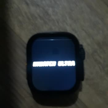 Trendyol Aldığım Mateo Saat Bozuldu Telefonlara Cevap Verilmiyor