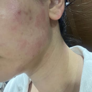 Pembe Bioderma Yüz Yıkama Jeli