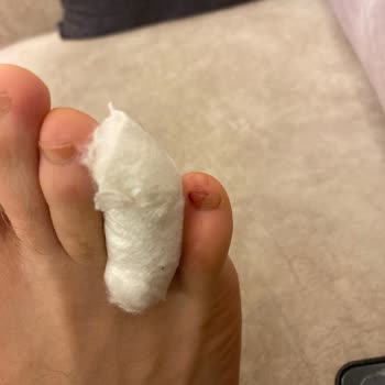 Lüx Doğukent Hamamı Havuzda Yaralanma Ve İlgi Eksikliği