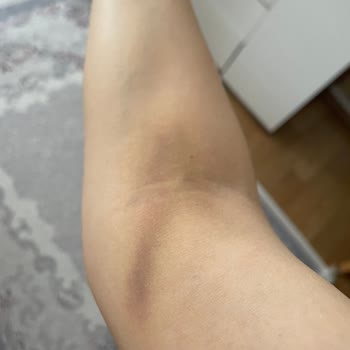 Ufuk Üniversitesi Hastanesi / Kan Alma