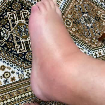 Natomed Hastanesi Ortopedi Uzmanı İlgisizliği