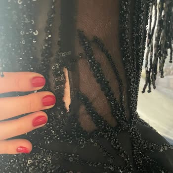 MyRentalDress Elbise Sorunu Ve Müşteri Hizmetleri Hayal Kırıklığı