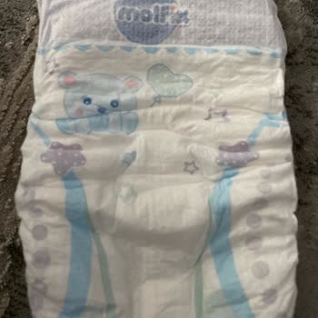 Molfix Sızdırma Ve Pişik Sorunu