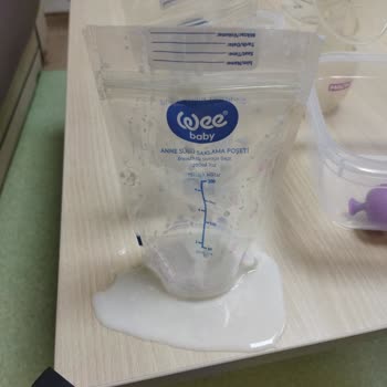 Wee Baby Süt Saklama Poşeti Sorunu