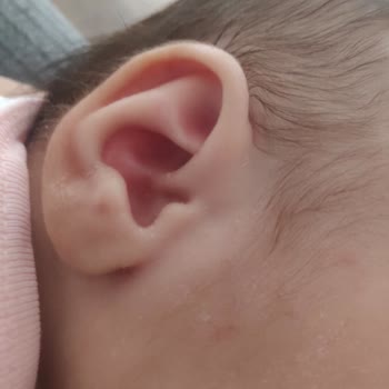 Mustela Şampuanı Egzamaya Yol Açtı