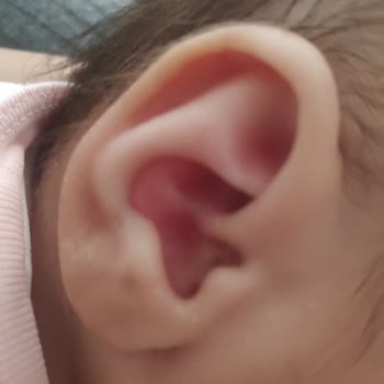 Mustela Şampuanı Egzamaya Yol Açtı