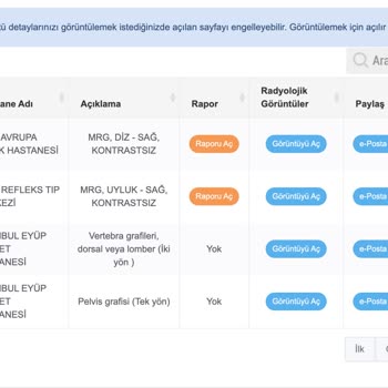 Türkiye Sigorta Ameliyat Onay Mağduriyeti