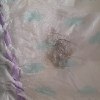 BİM Bebek Bezi Endişesi: Kalite Ve Sağlık Sorunları