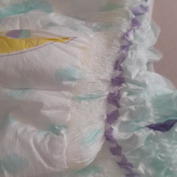 BİM Bebek Bezi Endişesi: Kalite Ve Sağlık Sorunları
