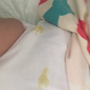 Prima Marka Bezde Sızdırma Sorunu (! ). Bez Paketinde Problem Var