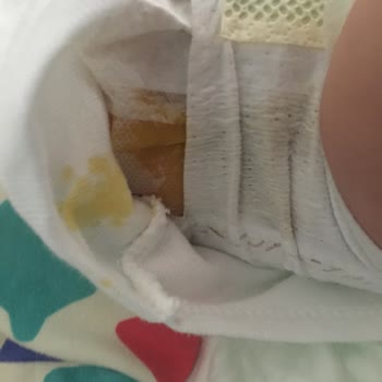 Prima Marka Bezde Sızdırma Sorunu (! ). Bez Paketinde Problem Var