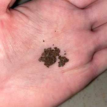 Nescafe Gold Kahvede Pamuklama Var