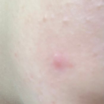 The Purest Solutions Gereğinin Yapılmasını İstiyorum