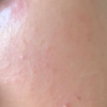 The Purest Solutions Gereğinin Yapılmasını İstiyorum