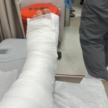 Zara Bot Tabanı Kaydığı İçin Ayağımı Kırdım