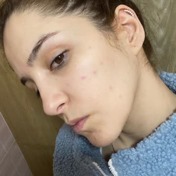 Watsons Cilt Bakım Serumu Hayal Kırıklığına Uğrattı