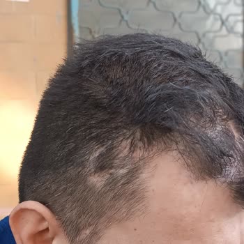Jet Turizm Dörtyol Kaza Anılarım