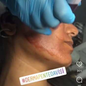 Laviva Güzellik Merkezi İcra Sorunu!