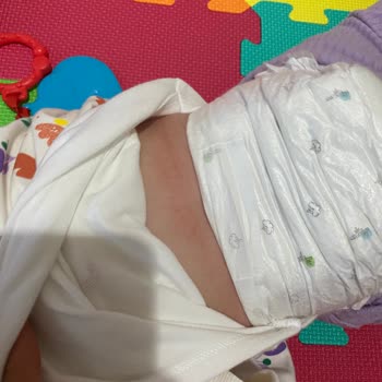 Sleepy Bio Naturel 5 Alerji Yaptı!