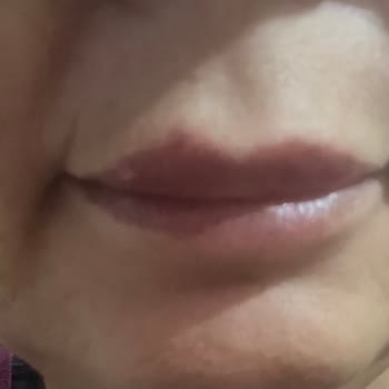 Adana The Lüks Estetica