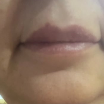 Adana The Lüks Estetica