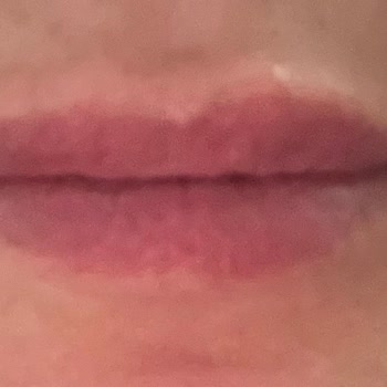 Adana The Lüks Estetica