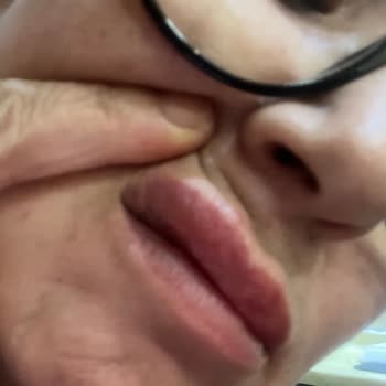 Adana The Lüks Estetica