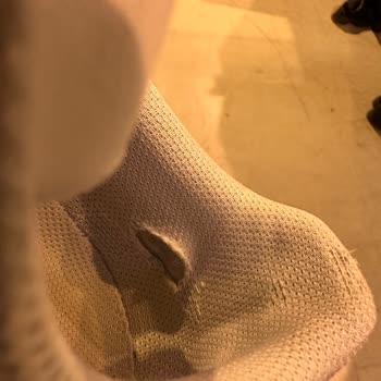 Adidas Superstar Astar Yırtılması