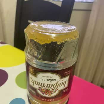 Balparmak Dibinde Tortu Şikayetim