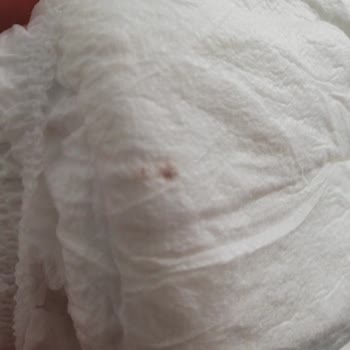 Sleepy Bebek Bezi Kahverengi Lekeler