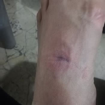 Sportive Defolu Nike Grotex Spor Ayakkabının Değişiminin Yapılmaması