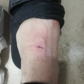 Sportive Defolu Nike Grotex Spor Ayakkabının Değişiminin Yapılmaması